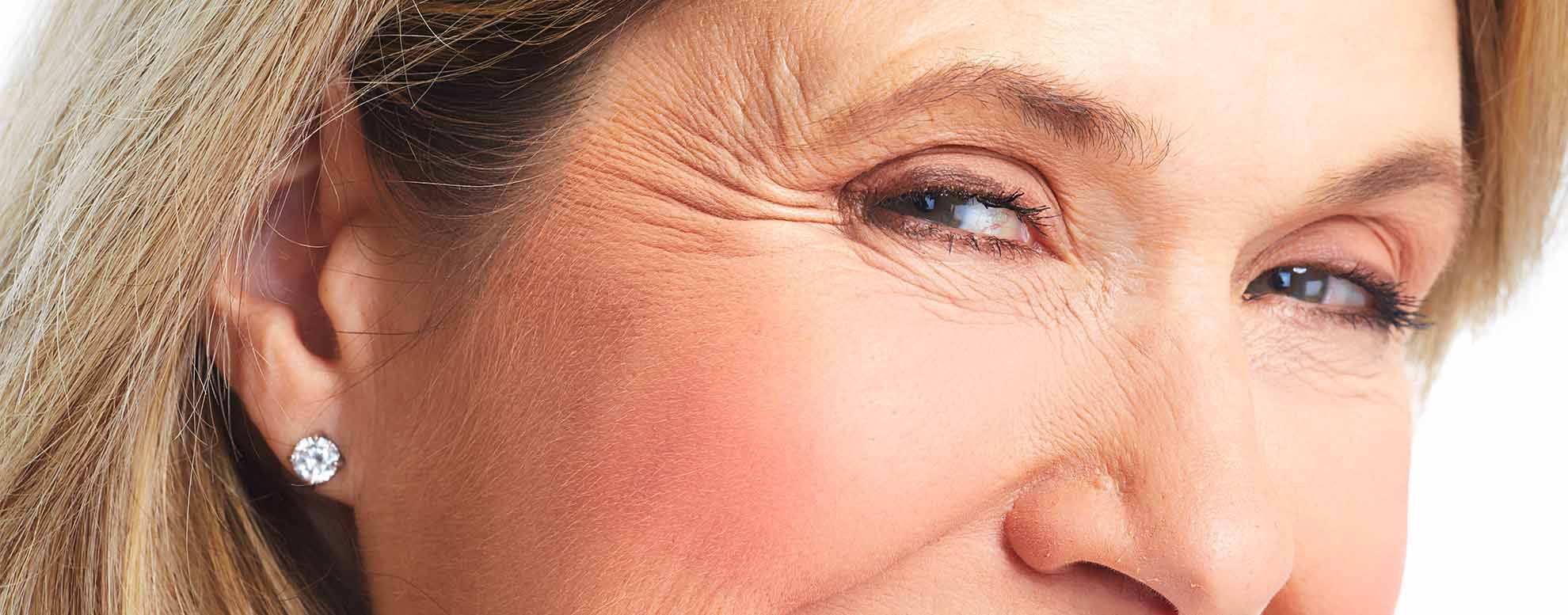 Heavy Eyelids | Droopy Eyelid Treatment | The Aesthetic Skin Clinic