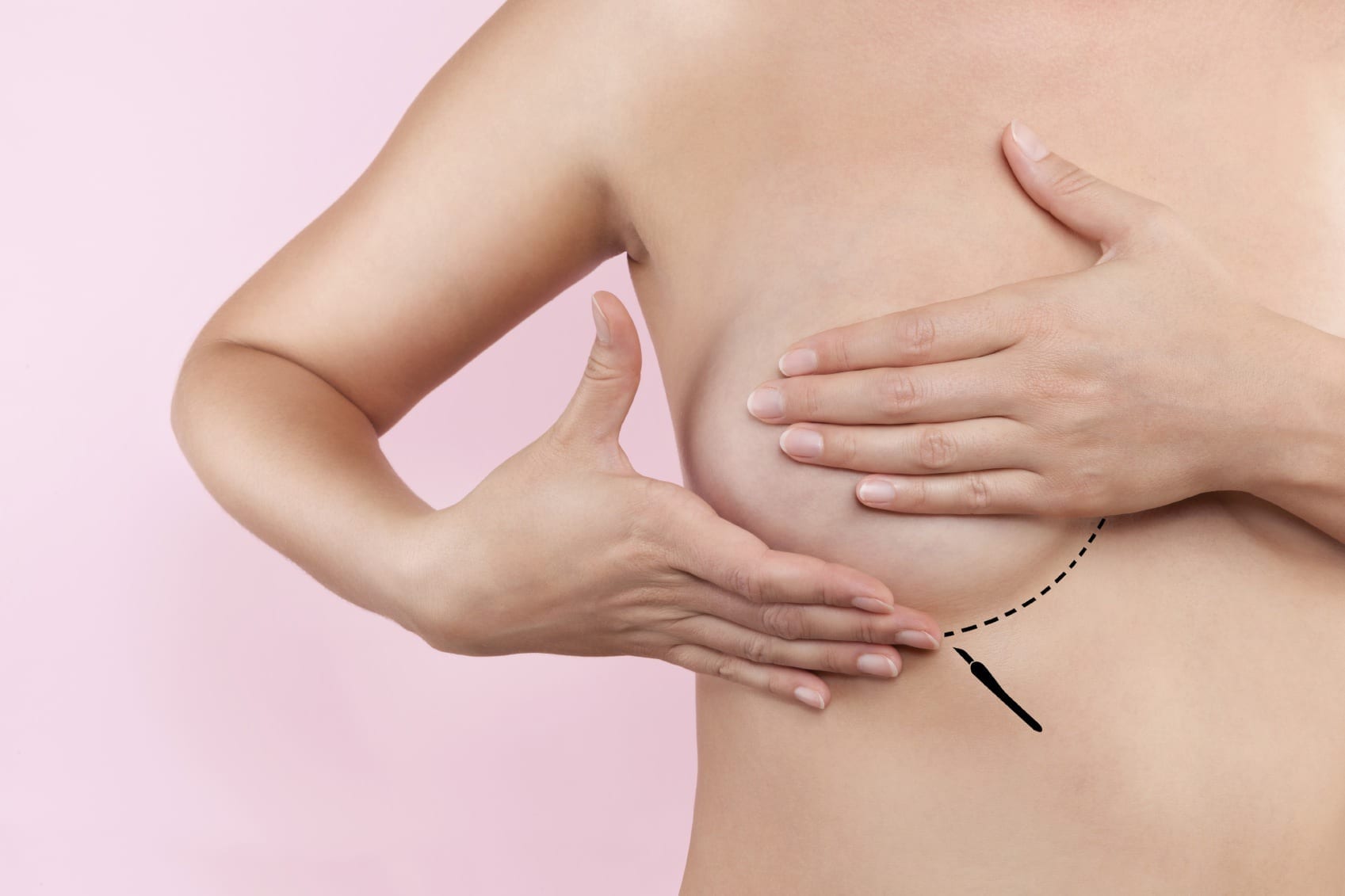 Getting a Breast Lift After Weight Loss?