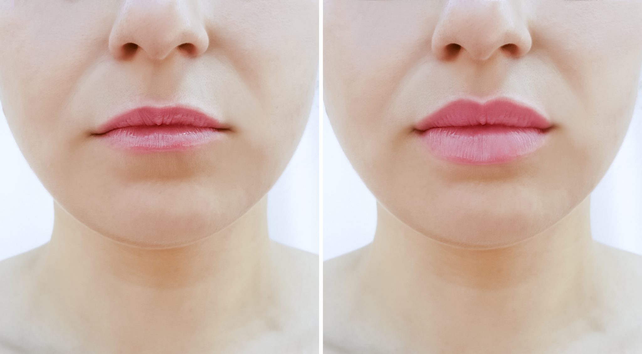 How To Make Your Thin Lips Look Fuller The Aesthetic Skin Clinic