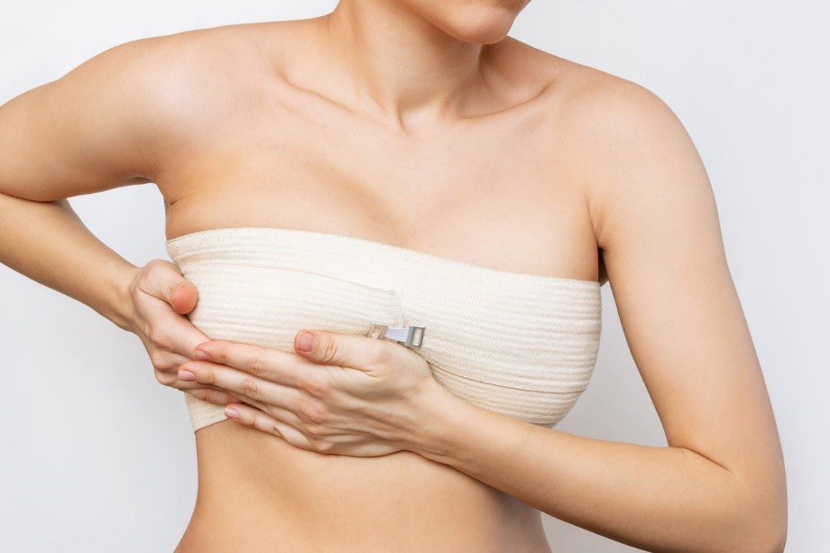 How to Reduce Swelling After Breast Reduction
